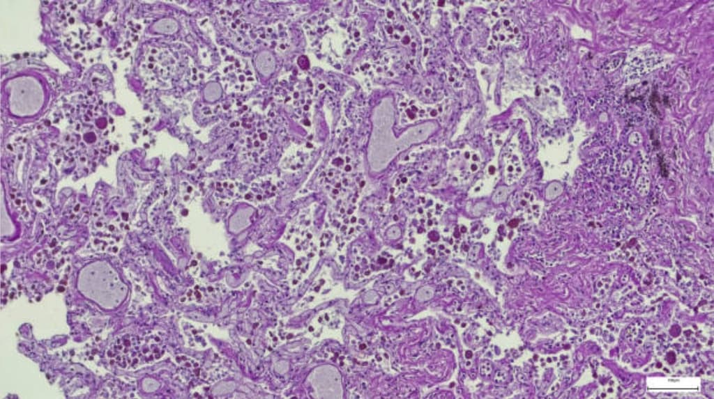 Medical slides visualization